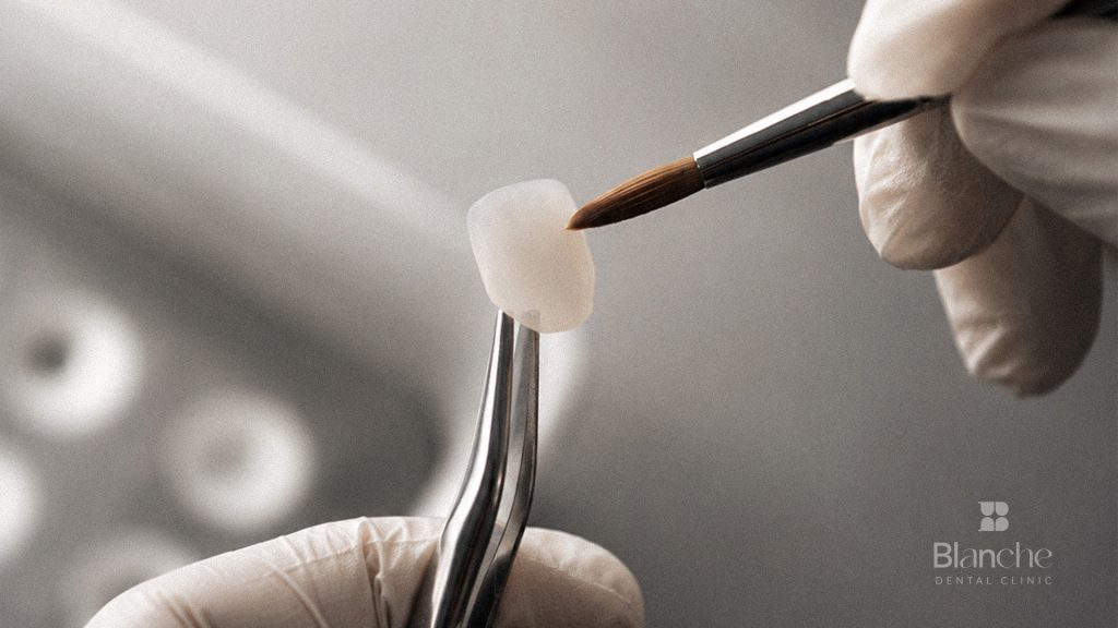 Five Questions That Protect Your Enamel