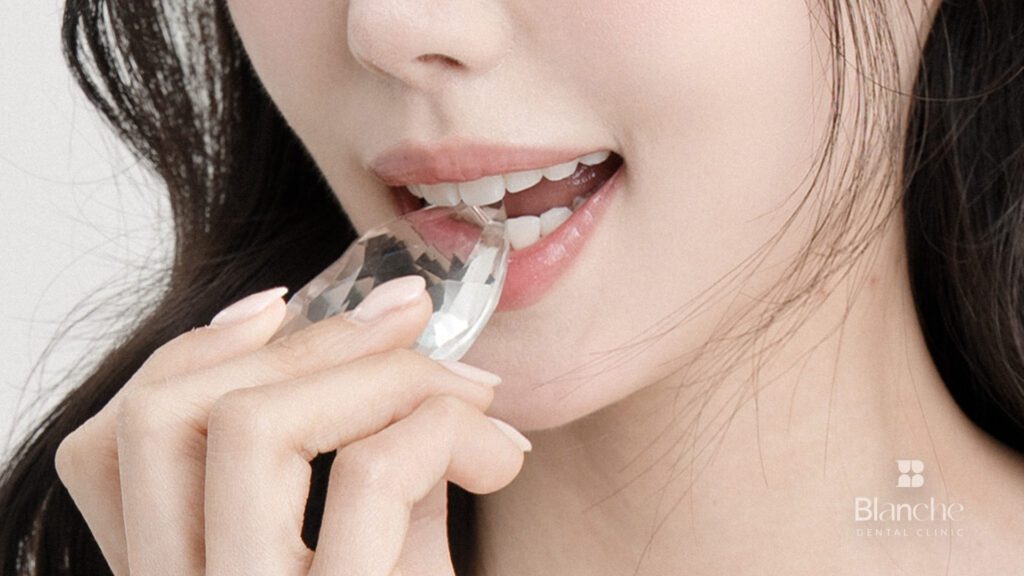 교정 장치 떨어짐, 빈도를 확실히 줄이는 방법