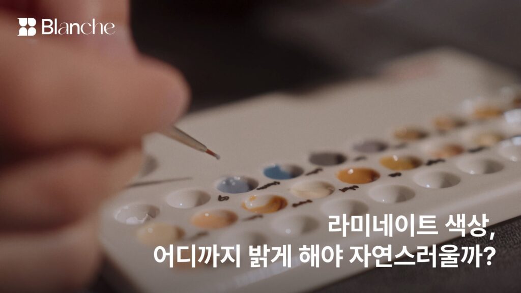 라미네이트 색상, 어디까지 밝게 해야 자연스러울까? 색을 정하는 5가지 기준