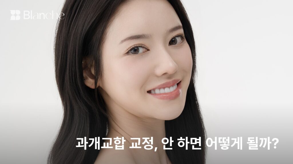 과개교합 교정, 안 하면 어떻게 될까? 방치했을 때 생기는 일과 치료 기준