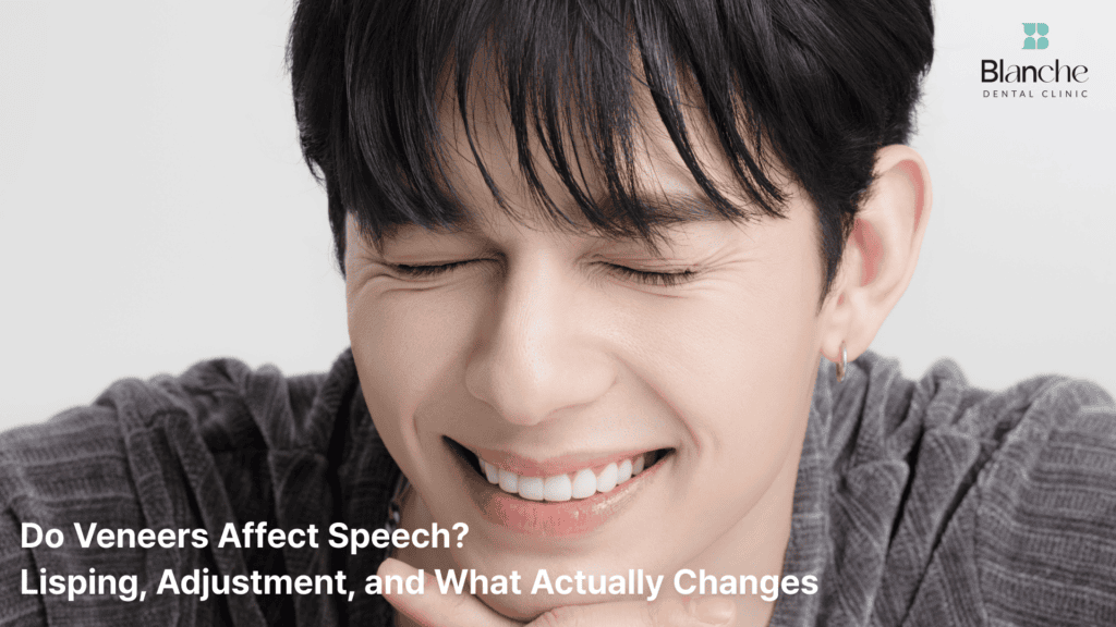 Do Veneers Affect Speech? Lisping, Adjustment, and What Actually Changes