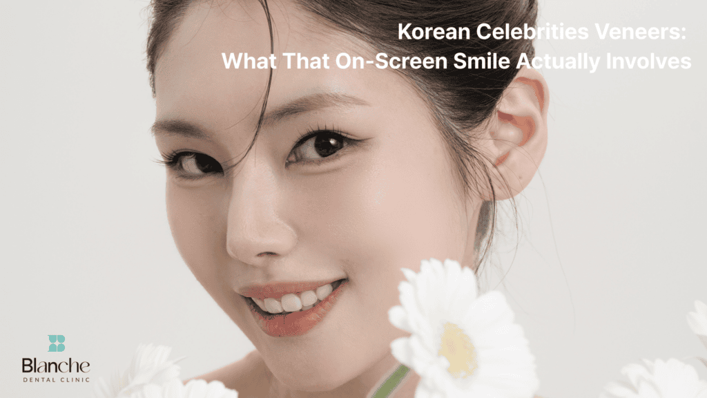 korean-celebrities-veneers
