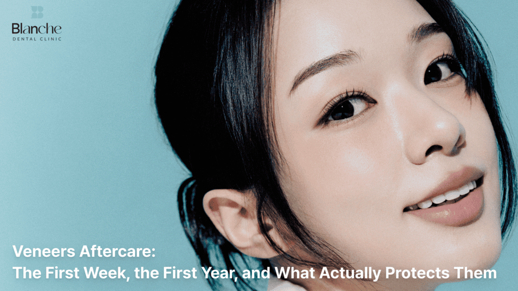 Veneers Aftercare: The First Week, the First Year, and What Actually Protects Them