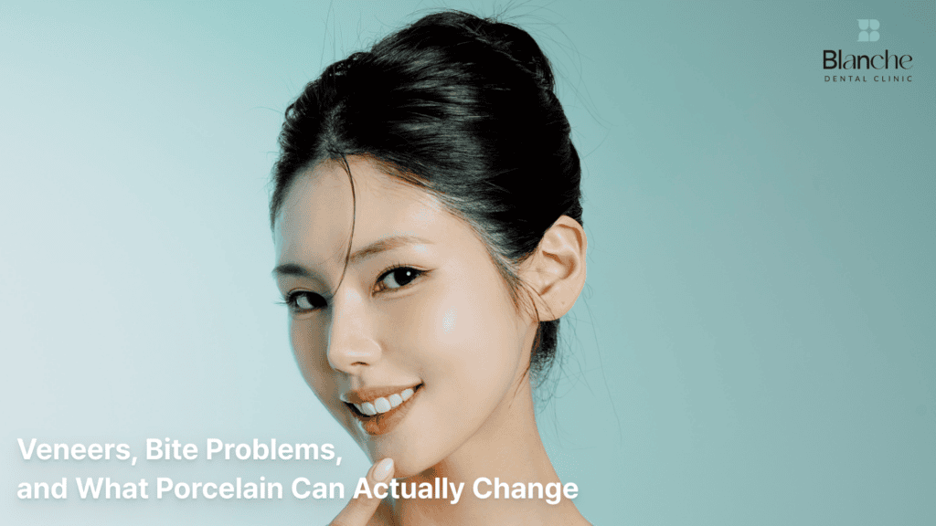 Veneers, Bite Problems, and What Porcelain Can Actually Change