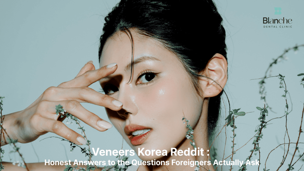 veneers-korea-reddit-answers