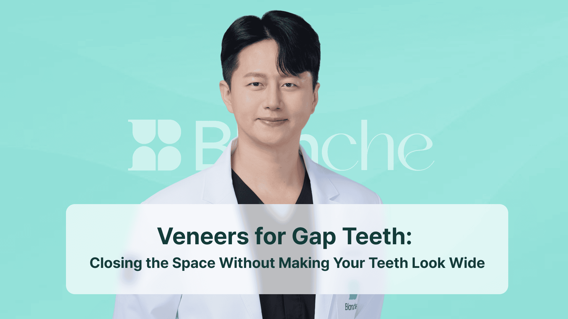 Veneers for Gap Teeth: Closing the Space Without Making Your Teeth Look Wide