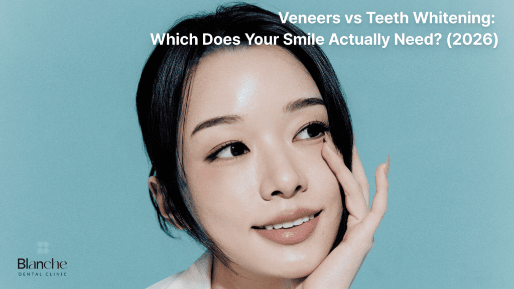Veneers vs Teeth Whitening: Which Does Your Smile Actually Need? (2026)