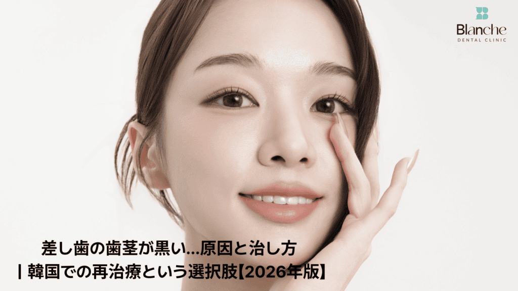 差し歯の歯茎が黒い…原因と治し方
｜韓国での再治療という選択肢【2026年版】