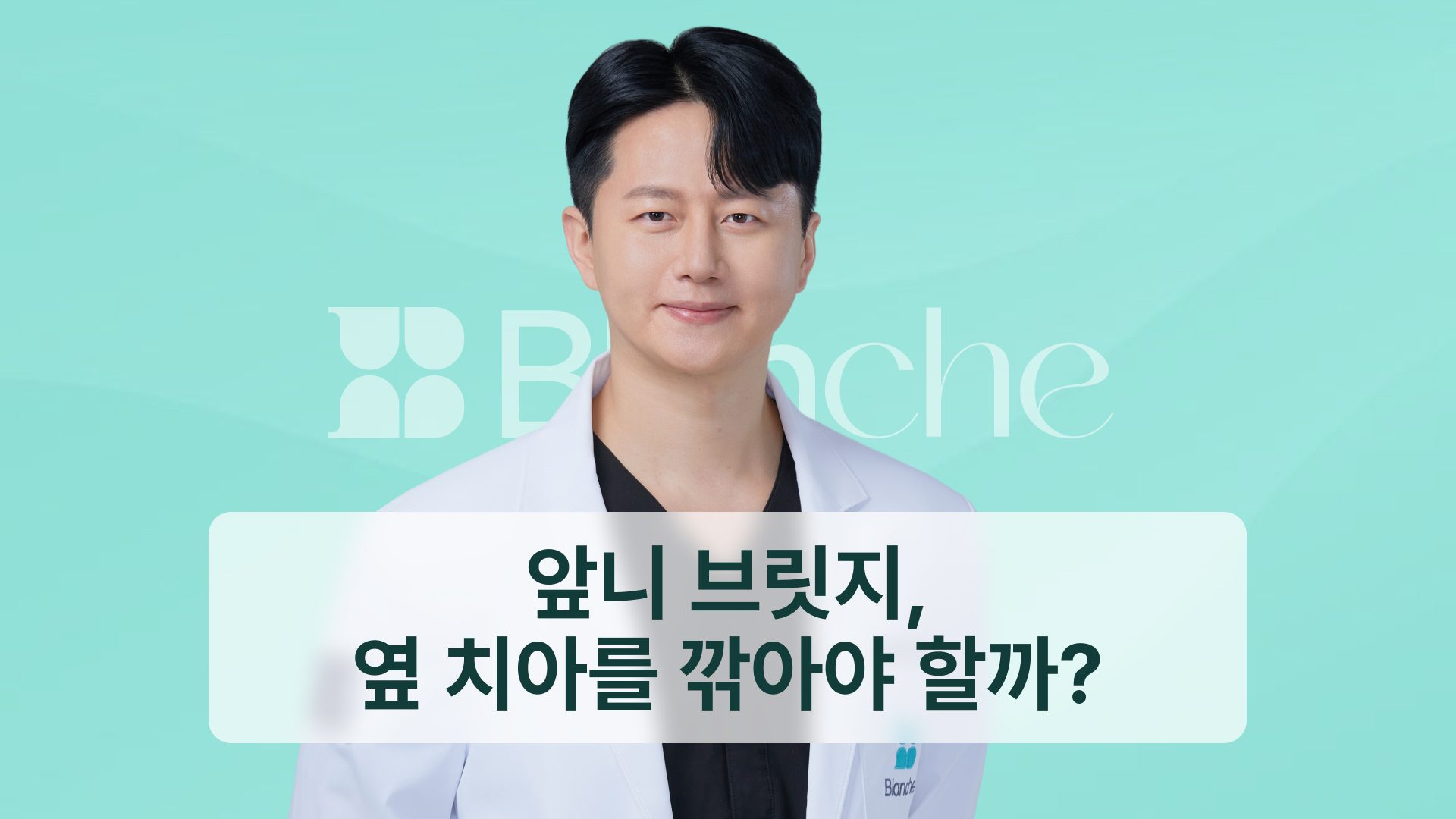 앞니 브릿지, 옆 치아를 깎아야 할까? 비용과 수명을 가르는 기준 5가지