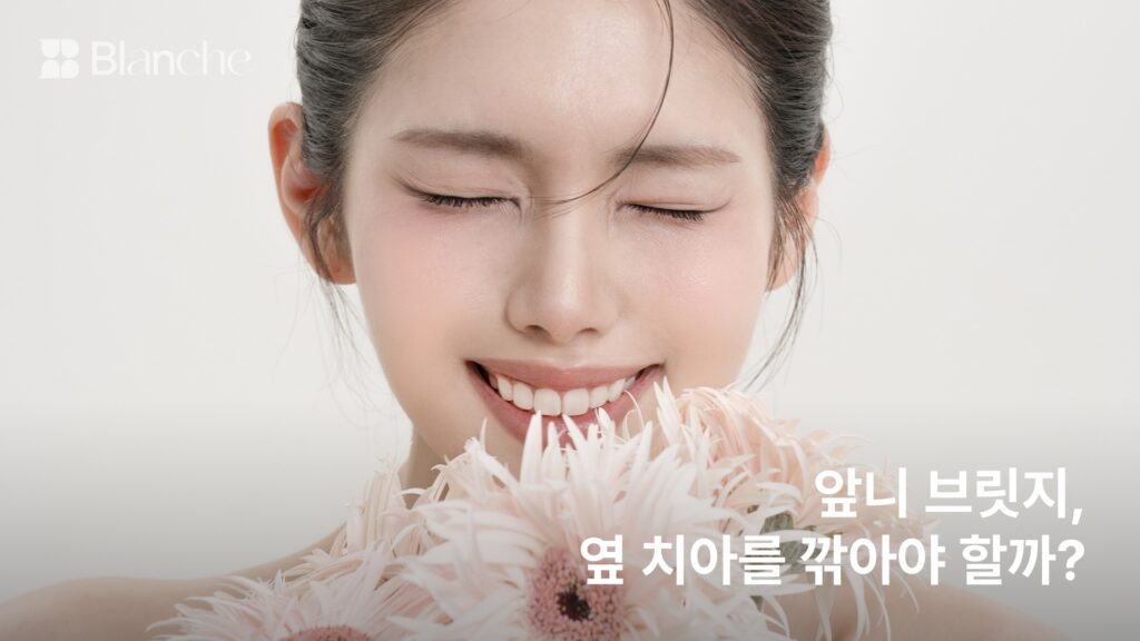 앞니 브릿지, 옆 치아를 깎아야 할까?