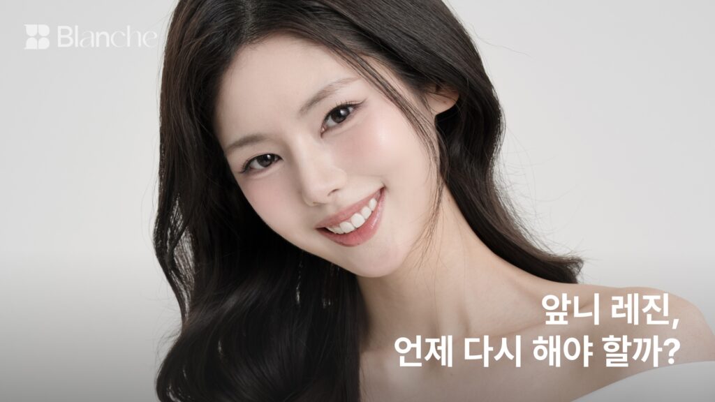 앞니 레진, 언제 다시 해야 할까?