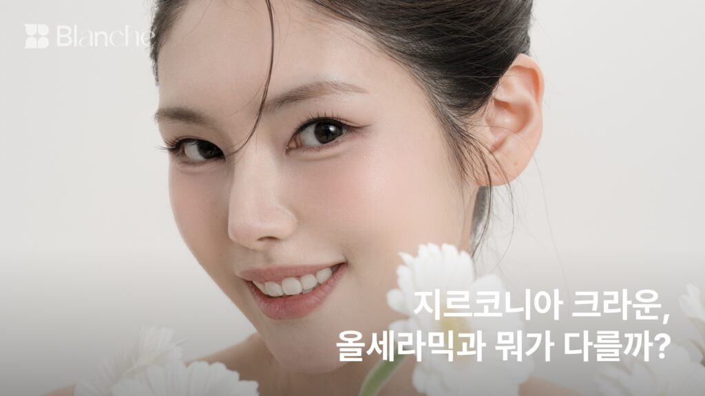 지르코니아 크라운, 올세라믹과 뭐가 다를까? 앞니 재료를 가르는 기준 5가지