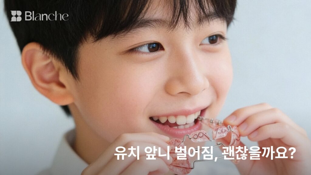 유치 앞니 벌어짐, 괜찮을까요?