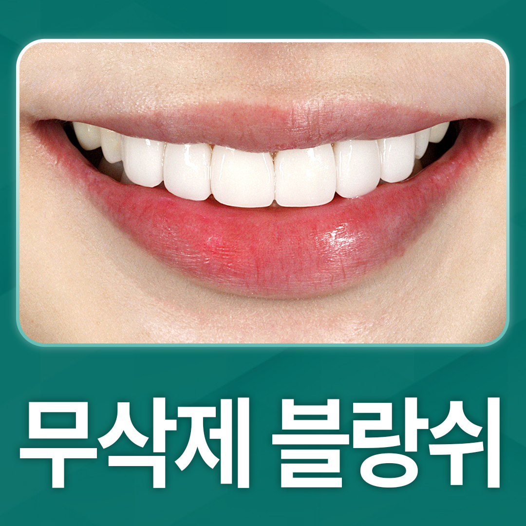 무삭제 블랑쉬